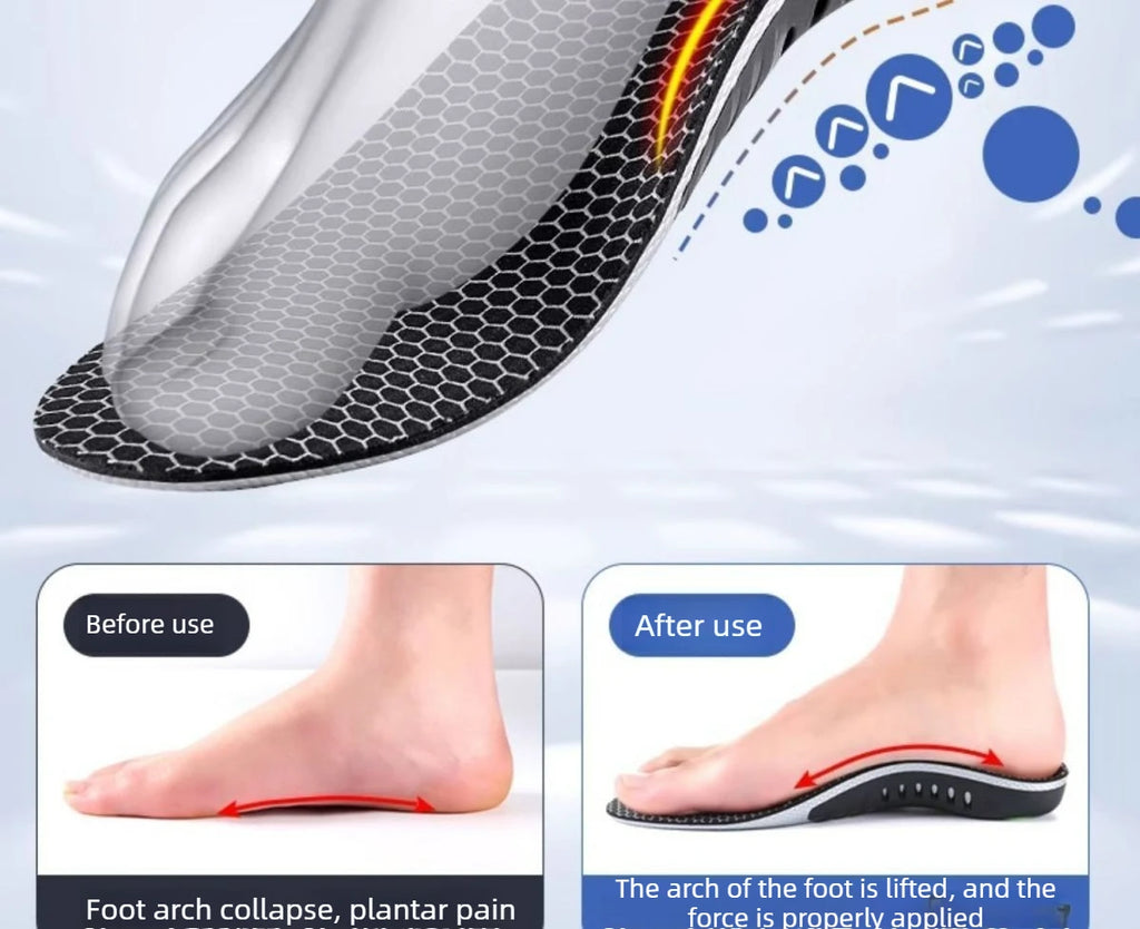 Arch Support Insoles for Runners